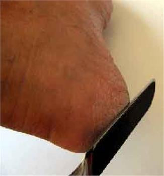 PEEL AWAY CALLUS REMOVE KIT (CS3490) Grit-120-80