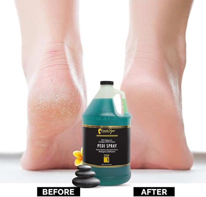 Pedi Spray Antiseptic, Mint & Eucalyptus - Effective Foot Care - 128 Ounces