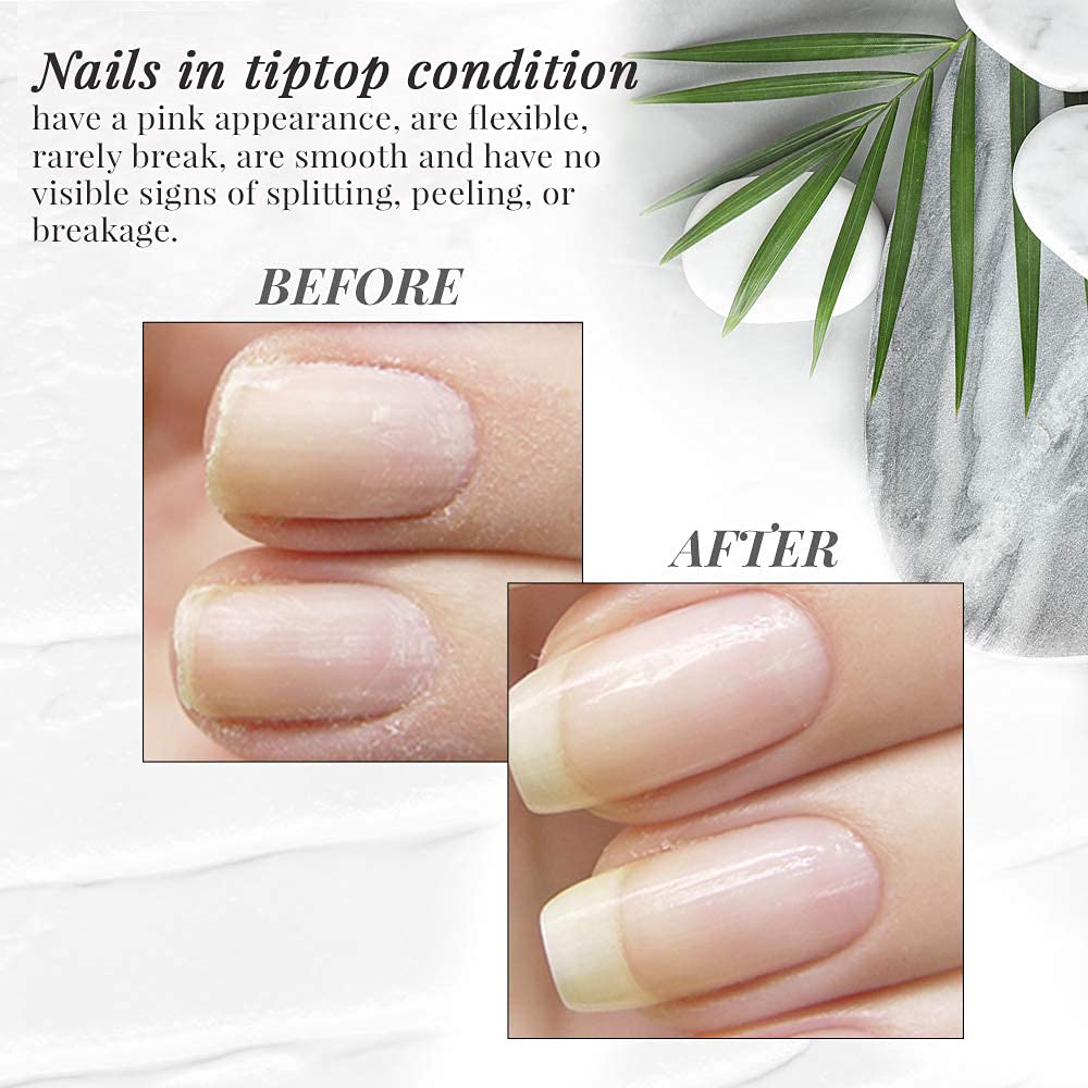 Nail Tek - Ridge Filler – Nails Foundation #1, Strengthening Base Coat for Strong, Healthy Nails lacquer(1 Pack)