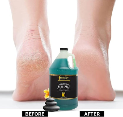 Pedi Spray Antiseptic, Mint & Eucalyptus - Effective Foot Care - 128 Ounces