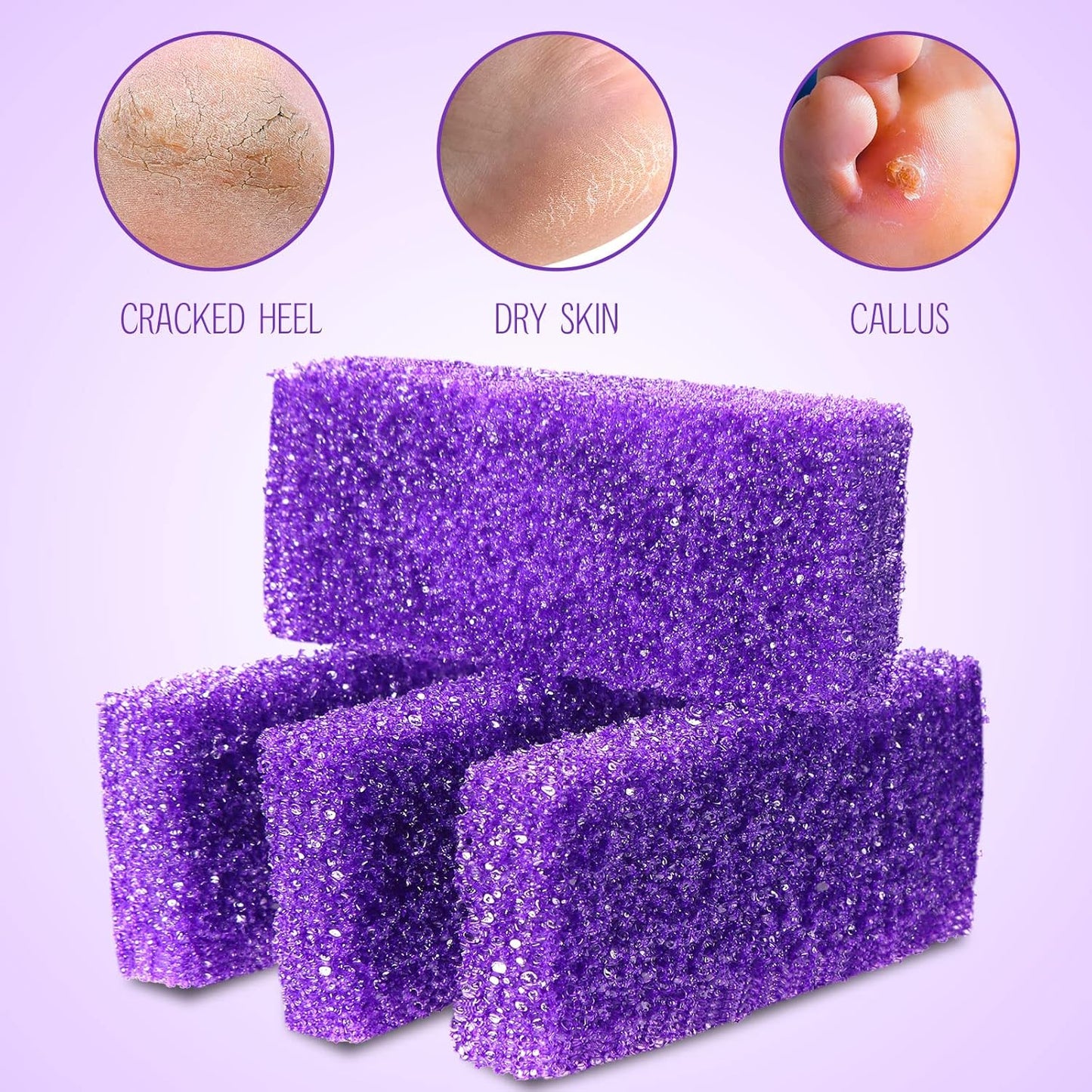 Pumice Stone Heel Cuticle Callus Remover Bath Spa (Purple) (40pcs)